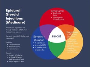 An Algorithmic Approach to Epidural Steroid Injections